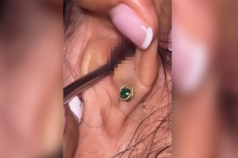 SVRBELO JE UVO DO BESVESTI, OTIŠLA U BOLNICU, A TAMO ŠOK: Kada su videli šta je unutra nisu mogli da veruju svojim očima! (FOTO)