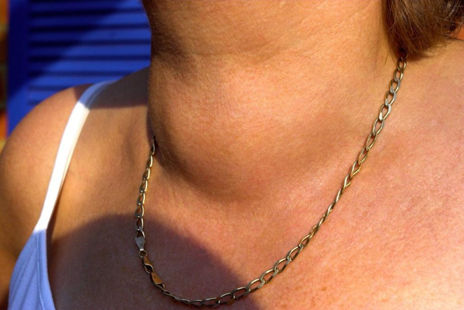 Za kafu smo svi znali, ali i ovo povrće je najgore za štitnu žlezdu: Zaboravite na njega odmah, može da dovede do..