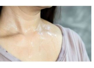 Mesta na kojima se znojite otkrivaju kakvog ste zdravlja: Evo kada se treba odmah javiti lekaru…FOTO