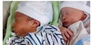 RODILA BLIZANCE, PA ZANEMELA OD ŠOKA: Lekari trčali da ih vide, otac mislio da je greška, sad imaju 5 godina i ČUDNI SU