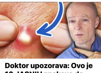 Doktor upozorava: Ovo je 10 JASNIH znakova da jedete previše šećera. Malo ko će ih primijetiti!