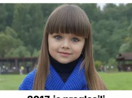 2017. je proglasili najljepšom djevojčicom na svijetu: POGLEDAJTE KAKO DANAS IZGLEDA