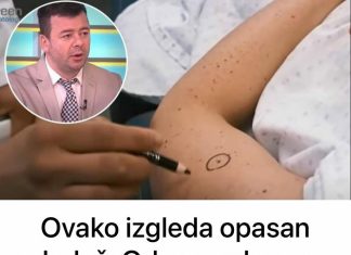 Ovako izgleda opasan mladež: Od normalnog se razlikuje po jednoj stvari, upozoravaju lekari