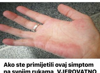 Ako ste primijetili ovaj simptom na svojim rukama, VJEROVATNO JE DA NEKI VAŽAN ORGAN NE RADI