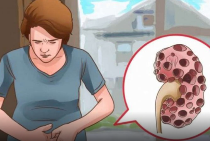 KADA SA BUBREZIMA NEŠTO NIJE U REDU, TELO ŠALJE OVE SIGNALE: 6 simptoma koje ne smete ignorisati!