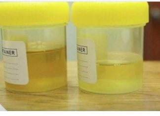 Osjetite li jak miris urina kada ustanete sa sjedišta? To nije infekcija urinarnog trakta, već mnogo opasnije stanje koje vas muči!