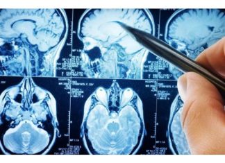 Najzdravije povrće na svijetu: Naučnici kažu da mozak može učiniti 11 godina mlađim