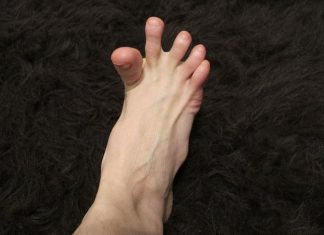 DA LI VAM SE GRČE PRSTI NA STOPALIMA? Evo na šta vas to upozorava, može biti znak većih problema