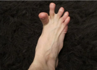 DA LI VAM SE GRČE PRSTI NA STOPALIMA? Evo Na Šta Vas To Upozorava, Može Biti Znak Većih Problema