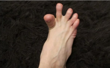 DA LI VAM SE GRČE PRSTI NA STOPALIMA? Evo Na Šta Vas To Upozorava, Može Biti Znak Većih Problema