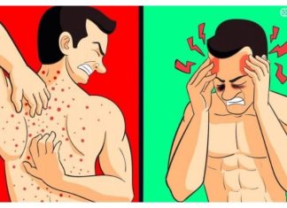 VAŠE TIJELO VAM ŠALJE UPOZORENJE: 12 znakova da jedete previše šećera SHVATITE OZBILJNO! Broj 5 nikako ne zanemarujte!