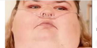 Godinama se gojila, a kad je prešla 300kg umre joj i muž od debljine: Ova žena je doktore šokirala transformacijom