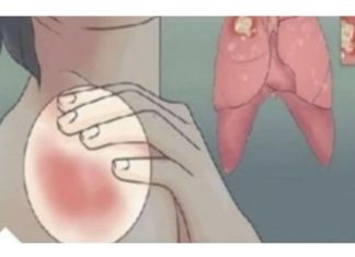 EVO KAKO MOŽETE PROVJERITI DA LI IMATE SLAB IMUNITET: 6 Znakova Lošeg Imuniteta, Ovako Tijelo Upozorava