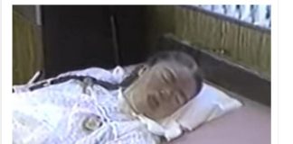 Sa 16 je obolela od gripa i pala u komu iz koje se nije budila 42 godine: Kad je otvorila oči, majka zanemela od prizora