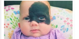 Nakon rođenja, otac od nje glavu okretao, a majka vrištala od šoka: Začudili su se da danas Natalija ovako izgleda