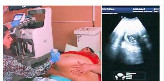 Trudna žena ima 226 kilograma i došla je na ultrazvuk, a onda je medicinska sestra podigla njen stomak i pogledala bolje… (VIDEO)