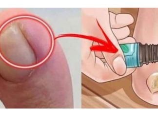 NAJBOLJI SAVJET ZA URASTAO NOKAT: Promjenu ćete osjetiti za nekoliko minuta, a djeluje i protiv modrica i gljivica!