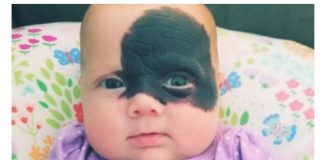 Nakon rođenja, otac od nje glavu okretao, a majka vrištala od šoka: Začudili su se da danas Natalija ovako izgleda