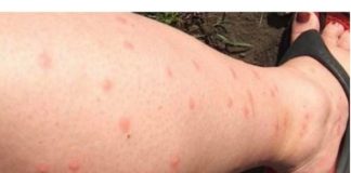 KOMARCI VAM PRAVE PAKAO OD ŽIVOTA? Samo isijecite OVO VOĆE na pola i ostavite u sobi, VIŠE IH NIKADA NEĆETE VIDJETI BLIZU!