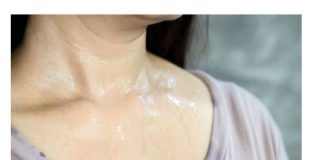 Mesta na kojima se znojite otkrivaju kakvog ste zdravlja: Evo kada se treba odmah javiti lekaru…FOTO