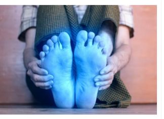 3 ZNAKA VIS0K0G H0LESTER0LA: 0dmah pogledajte vaše ruke i noge