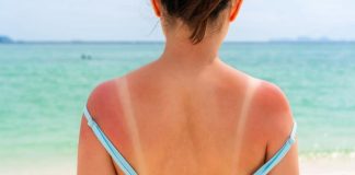 Za ovu biljku kažu d Najbolje prirodno rešenje za opekotine od sunca: Smiruje upale već posle prvog nanošenja, a gel se može kupiti svuda! Evo o čemu je reč