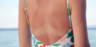 12 letnjih zdravstvenih rizika na koje morate obratiti pažnju: Od opekotina od sunca i dehidracije do ujeda insekata i alergija