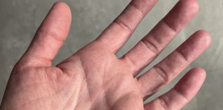 Samo zaista posebni ljudi imaju ovaj simbol na levom dlanu, njima se smeši veliki uspeh u životu, bogatstvo i sreća