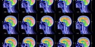 Svetski neurohirurg otkrio kako da vam mozak radi kao da imate 25: Ključ je u ova 3 saveta