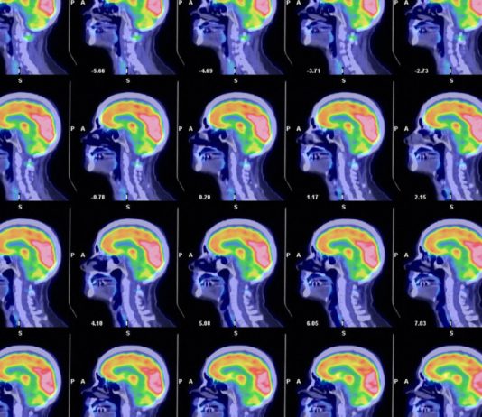 Svetski neurohirurg otkrio kako da vam mozak radi kao da imate 25: Ključ je u ova 3 saveta