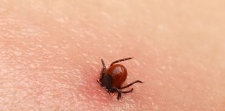 Bezbolno je i nema čupanja: Doktorka otkrila trik kako da se krpelj sam otkači sa kože