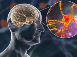 Hrani mozak i čuva pamćenje, JEDITE JE JEDNOM SEDMIČNO – NAJBOLJA NAMIRNICA PROTIV DEMENCIJE, MNOGI JE RIJETKO KAD JEDU!