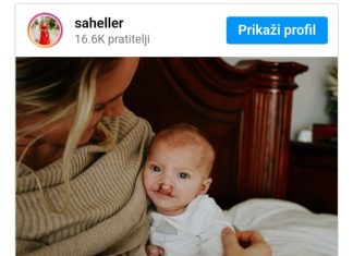 Doktori su mi rekli “abortiraj ovo smeće” kada su vidjeli ultrazvuk bebe: Nismo ih poslušali i moj sin danas ima 6 godina i izgleda ovako