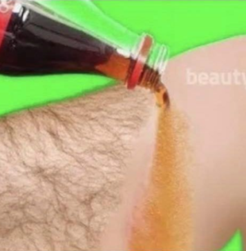 Prestanite se brijati! Super trik za najlakši način za uklanjanje dlačica s lica i tijela bez boli!