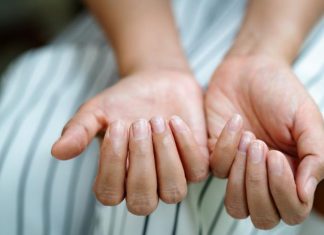 Boja polumeseca na noktima otkriva probleme s jetrom, srcem, plućima ili bubrezima: Evo kada da se zabrinete