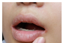 OPASNO PO ŽIVOT: Imate li neki od OVIH simptoma? Nagovještavaju nešto loše!