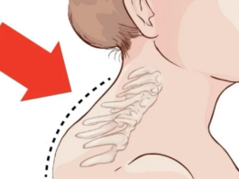 Kiropraktičar je pokazao 3 jednostavne vježbe koje će vam pomoći da ukl0nite “Grbu” u vratu: 0vo mi je najviše pomoglo! VIDEO