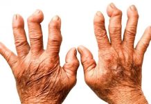 VAŠE KOSTI NE VOLE OVU HRANU: Ako Ovo Jedete, Bol Je Jači, Artritis Napreduje, Zglobovi Se Troše…