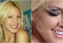 KAD SU SKUPILI PARE, URADILI SU ZUBE: POGLEDAJTE kako su izgledale domaće ličnosti PRIJE UMJETNIH ZUBA – CECA JE HIT (FOTO)