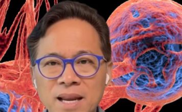 Onkolog otkrio jednostavne navike koje sprječavaju rak nakon 50. godine Onkolog otkrio jednostavne navike koje sprječavaju rak nakon 50. godine - featured image