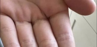 “Neočekivano i šokantno iskustvo: Ono što je izašlo iz mog grla će vas ostaviti bez riječi 😳” “Neočekivano i šokantno iskustvo: Ono što je izašlo iz mog grla će vas ostaviti bez riječi 😳” - featured image