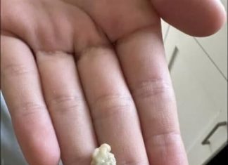 “Neočekivano i šokantno iskustvo: Ono što je izašlo iz mog grla će vas ostaviti bez riječi 😳” “Neočekivano i šokantno iskustvo: Ono što je izašlo iz mog grla će vas ostaviti bez riječi 😳” - featured image