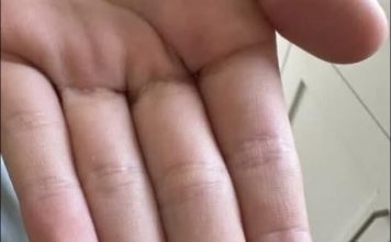 “Neočekivano i šokantno iskustvo: Ono što je izašlo iz mog grla će vas ostaviti bez riječi 😳” “Neočekivano i šokantno iskustvo: Ono što je izašlo iz mog grla će vas ostaviti bez riječi 😳” - featured image