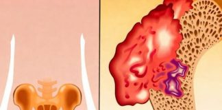 Bol u kostima, visok pritisak i tuga: Tijelo vam govori da mu NEDOSTAJE ovaj važan VITAMIN Bol u kostima, visok pritisak i tuga: Tijelo vam govori da mu NEDOSTAJE ovaj važan VITAMIN - featured image